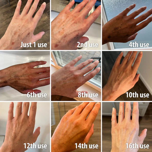 🌞Bee Venom & Ocean Natural Eczema Psoriasis Relief Cream (For all skin conditions)