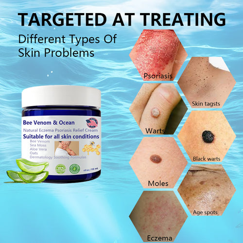 🌞Bee Venom & Ocean Natural Eczema Psoriasis Relief Cream (For all skin conditions)