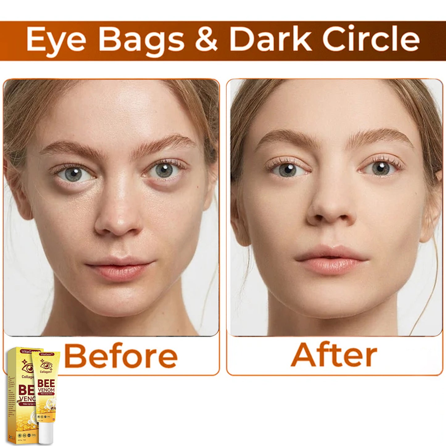 🐝VitaGaze™ Collagen+ Bee Venom Wake Up Eye Cream US Patented Exclusive Dermatologist Recommended