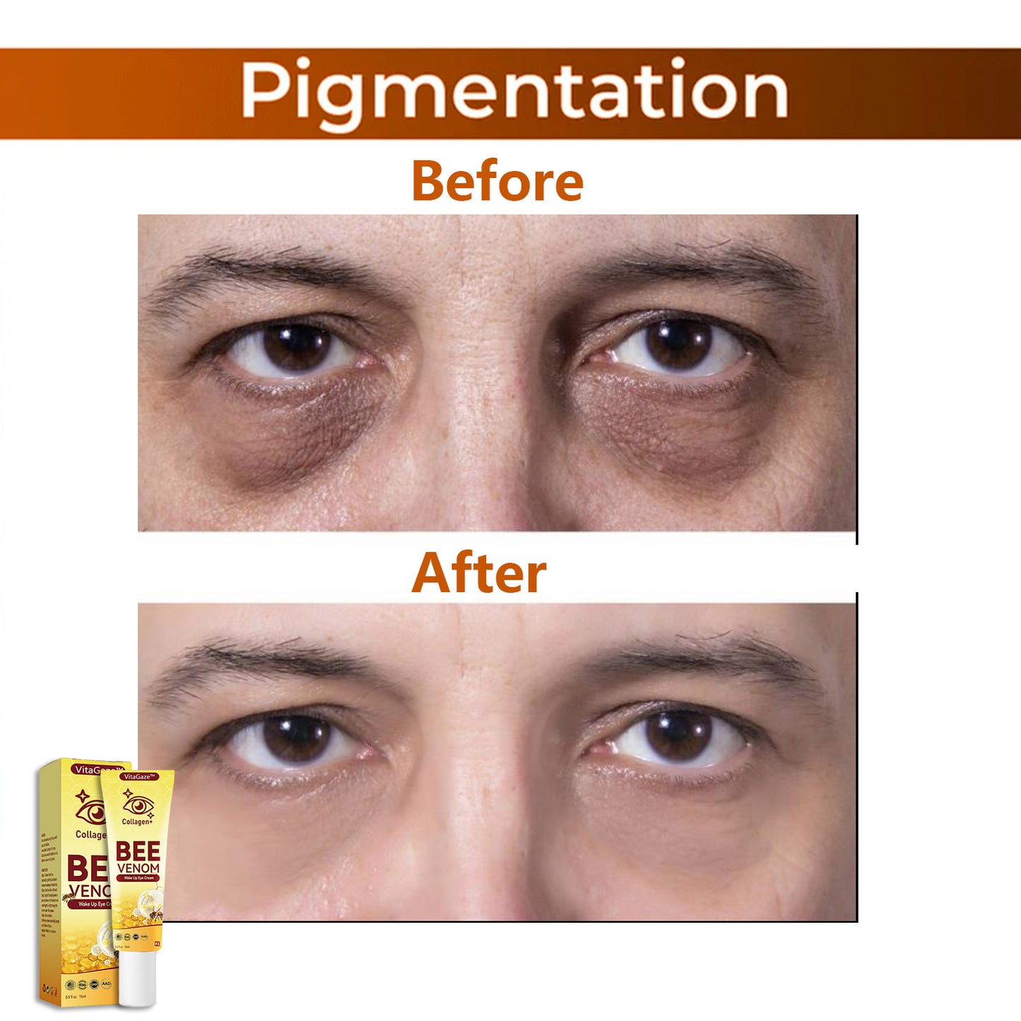 🐝VitaGaze™ Collagen+ Bee Venom Wake Up Eye Cream US Patented Exclusive Dermatologist Recommended
